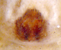 Philodromus sp.